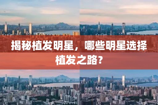揭秘植发明星，哪些明星选择植发之路？