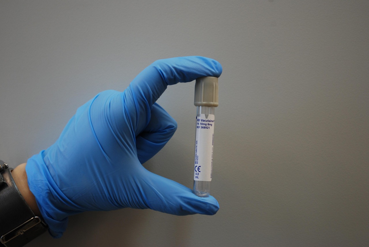慢性盆腔疼痛最新治疗进展研究综述